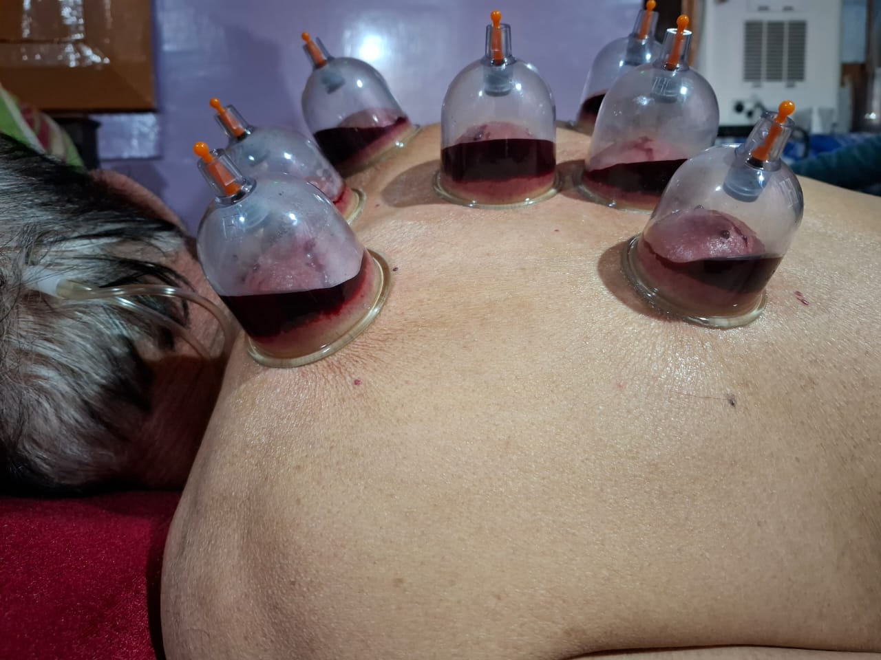 bakul